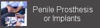 penile implants, penile prosthesis