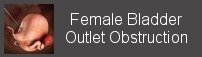 female Bladder outlet obstruction BOO