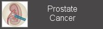 prostate cancer