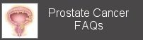 prostate cancer faqs