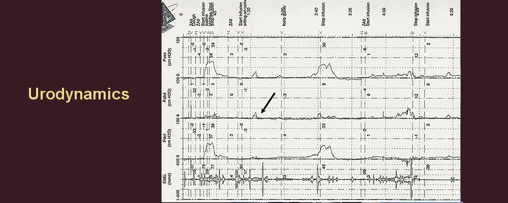 Urodynamics