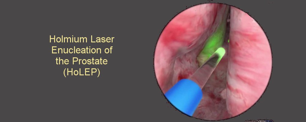 urological conditions